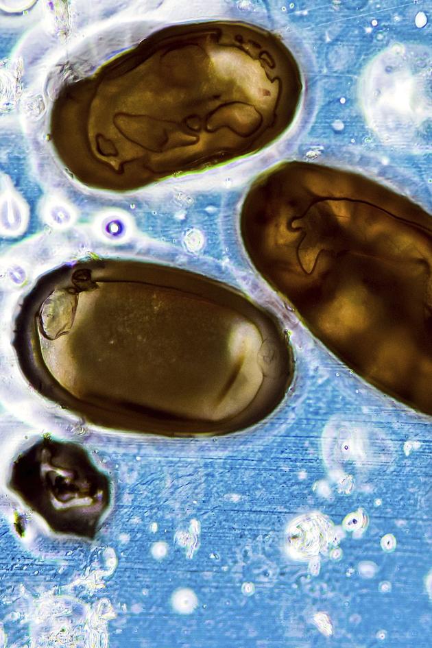 Life on Us: A Microscopic Safari