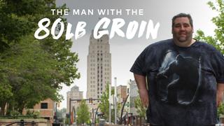 The Man with the 80lb Groin