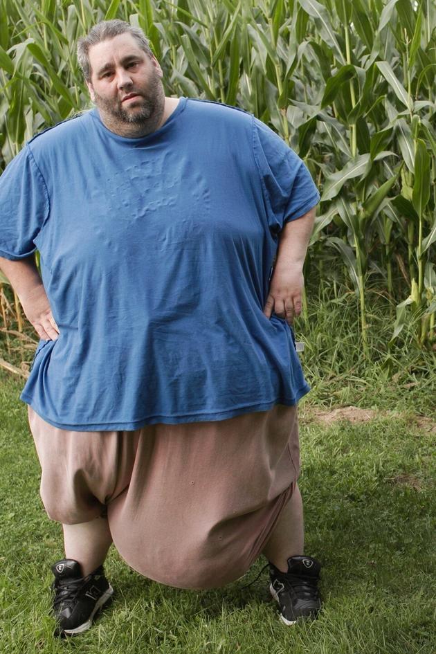 The Man with the 80lb Groin