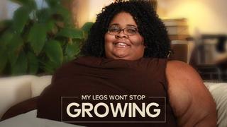My Legs Won't Stop Growing