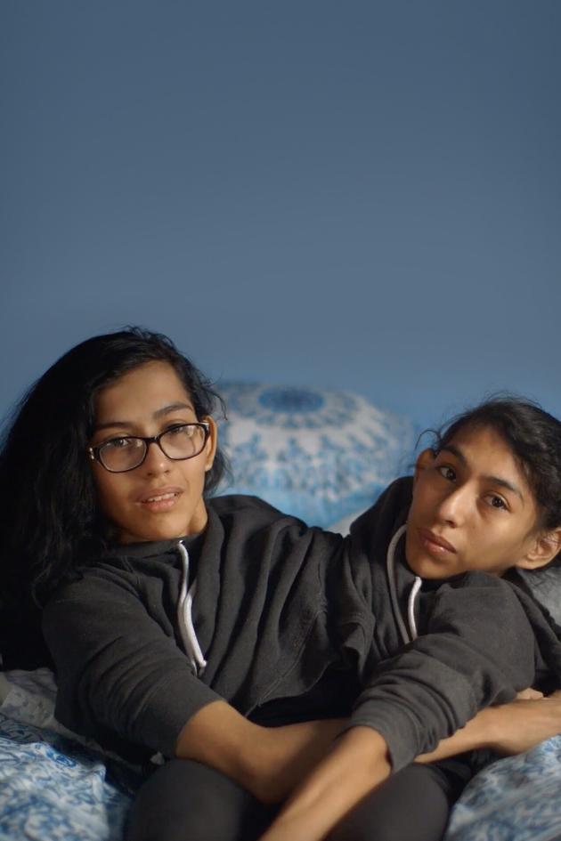 Extraordinary People: Conjoined Twins: Inseparable