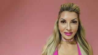 Botox Party Crasher