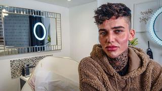 Serial Lip Filler