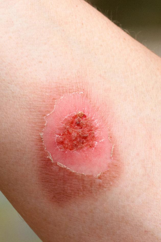 When Skin Goes Wrong