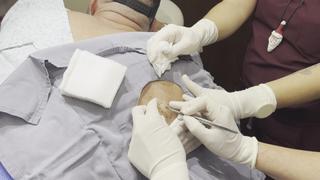 Dr. Pimple Popper