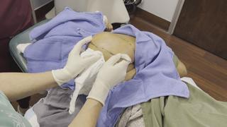 Dr. Pimple Popper