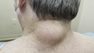 Dr. Pimple Popper
