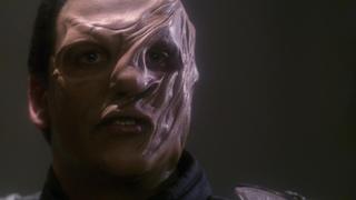 Anomaly