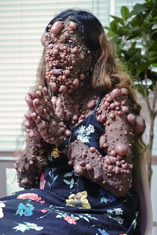 Take My Tumor