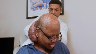 The Man With the Spicy Tumor