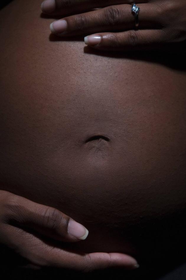 Obese and Pregnant