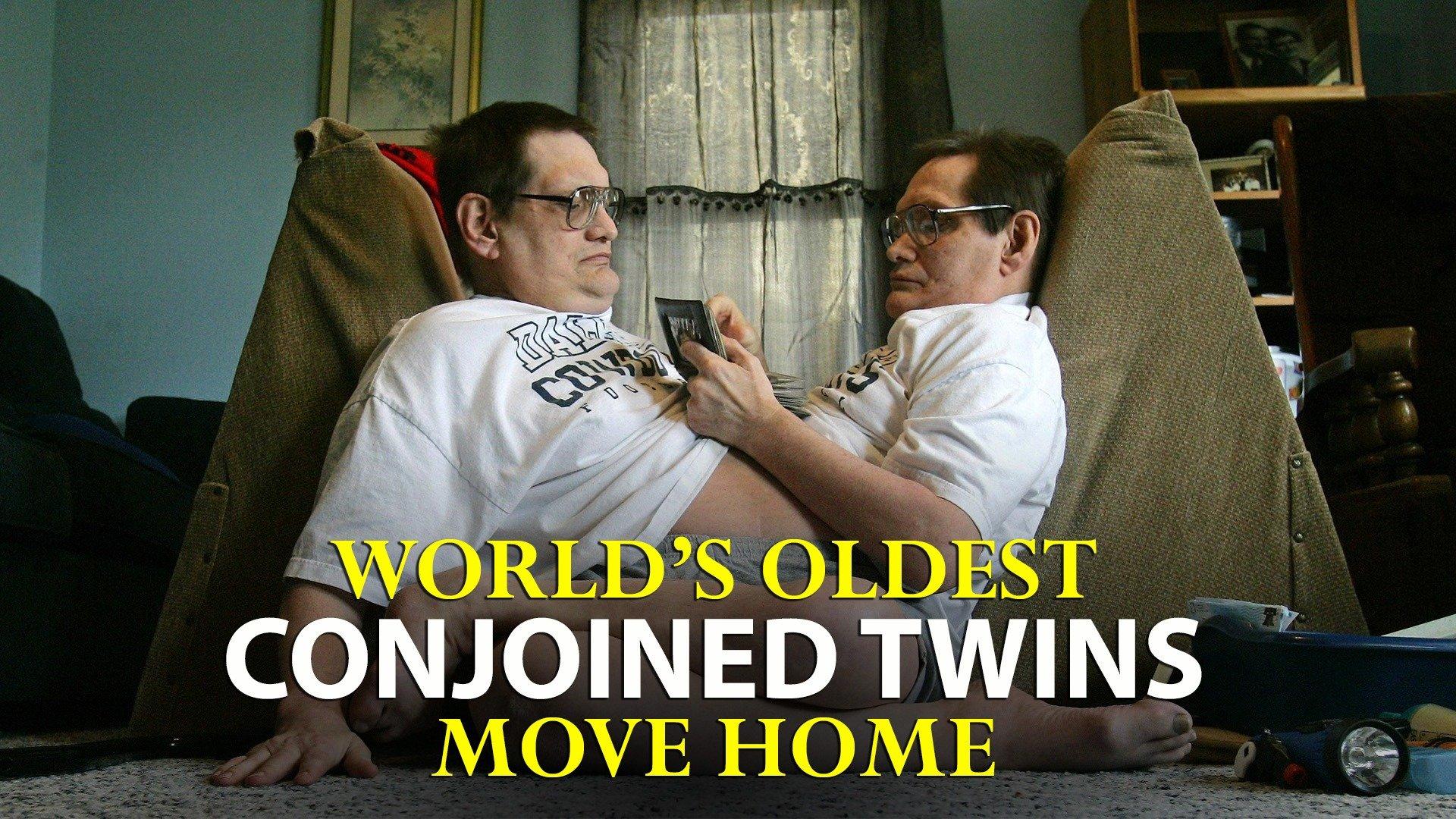 Watch World's Oldest Conjoined Twins Move Home Streaming Online on