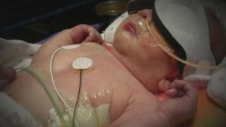 Too Young to Be Sick