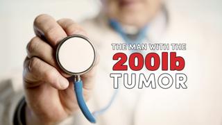 The Man With the 200lb Tumor